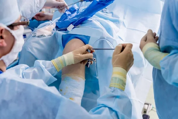 Knee Arthroscopic Surgery