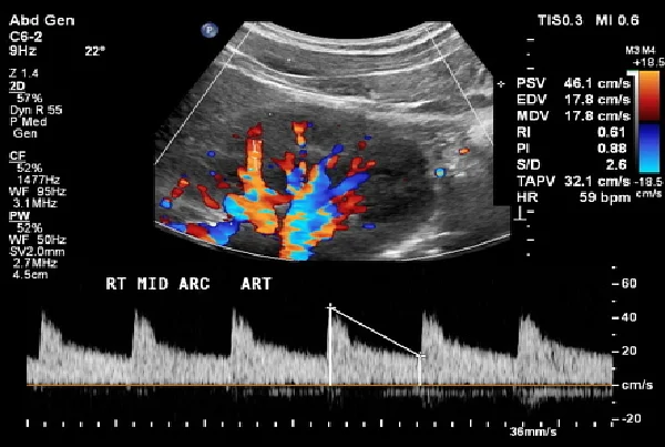 Renal